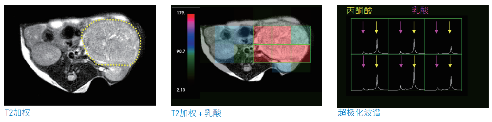 腫瘤學.png